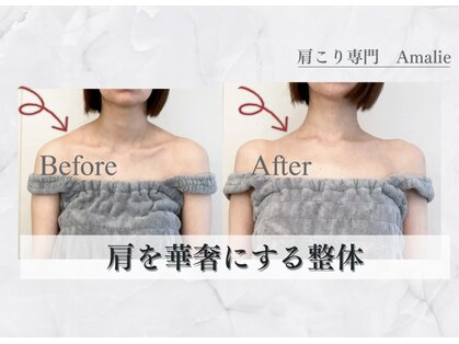 アマリエの写真