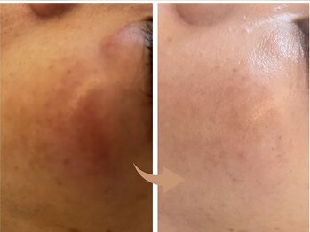 ソワンドゥース ヴェール(Soin douse Vert)/