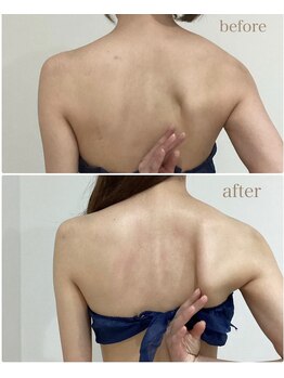 ハクカスパ(HAKUKA SPA)/