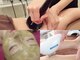 マイフェアレディ 今池(MyFairLady)の写真/プロの毛穴ケア韓国式ハーブピーリングで自信あふれる素肌へ！人気の痩身ラフォスで理想のボディラインも♪