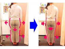 さらさ整骨院/産後骨盤矯正ビフォーアフター