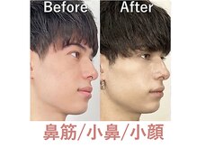 ラプリ 大宮店(Raplit)の雰囲気（小さくスッキリとした小鼻に☆顔と鼻の豆知識はブログに多数あり）