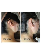 キュープ 下北沢店(Qpu)/ビフォーアフター