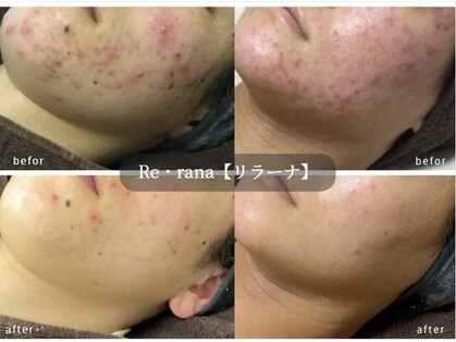 リラーナ(Re rana)の写真