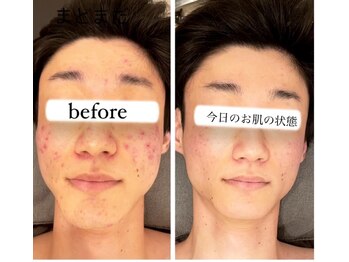 ジーニー(Genie)/気になるは解消できる