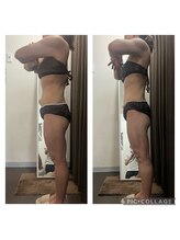 サロンドココ(Salon de COCO)/ハイパーナイフ痩身/全身痩身