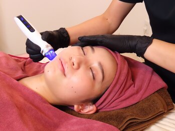 ミント(Mint)の写真/【丁寧なカウンセリングと確かな技術で結果出し◎】結婚式やイベントに向けて、短期でシャープな立体顔に♪