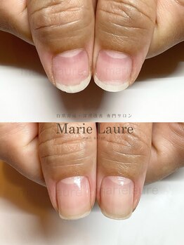 マリーロール 梅田店(Marie Laure)/深爪矯正/自爪育成/ネイルケア