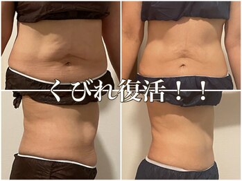 サルサナ(Salu Sana)/腰回りの厚み！くびれ出し！