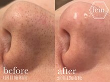 フェイン 青山店(fein.)