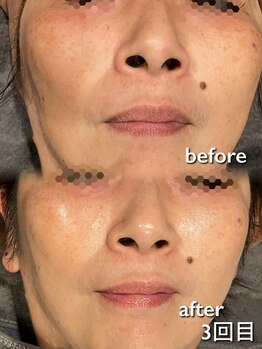 リイル バイ クレビア(REILE by Crebia)/お客様写真