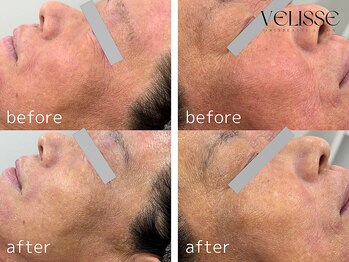 ヴェリス 福岡店(Velisse)/