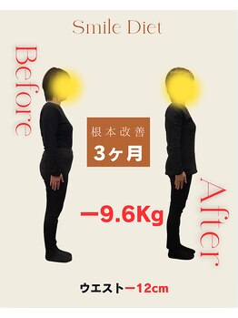 スマイル鍼灸整骨院 南熊本院/スマイルダイエット