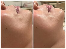 クランシュプール 恵比寿店/【ハリツヤ/弾力アップ】