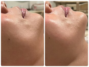 クランシュプール 恵比寿店/【ハリツヤ/弾力アップ】