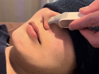 トータルエステサロン ポイント(POINT)の写真/毛穴の黒ずみや開きを徹底的に改善！お肌の汚れを取り除いてニキビケア◎透明感のある毛穴レスなツヤ肌に♪