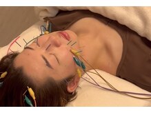 デルタエヌピー63+(δnp63+)/お客様施術例【小顔/薬院/福岡】