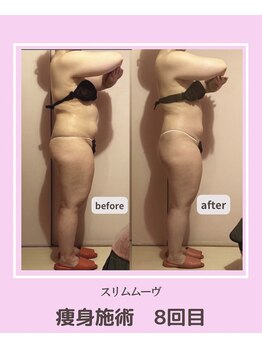 アコルデビューティー 恵比寿店(Acorde Beauty)/ビフォーアフター