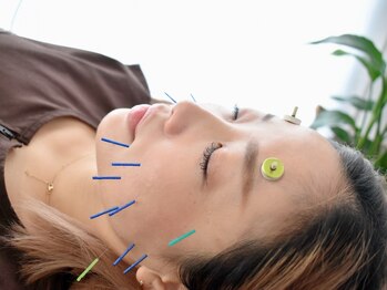 エミ(emi)の写真/《肌質改善を叶える美容鍼灸》肌トラブルにお悩みの方に◎