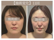 ドクターボディ 恵比寿店(Dr.Body)/【顔の大きさ/長さ/歪み 30代】