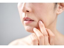 ナトゥーラ チュチュ(natura chuchu)/ほうれい線が気になる方へ