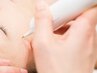 【エステモニター】本気のピンポイントシミケア(1~10ミリ程のサイズ3つまで)