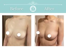 美人バスト 渋谷店の雰囲気（育乳プロが育ちづらい原因を徹底解明！バストアップは夢じゃない）