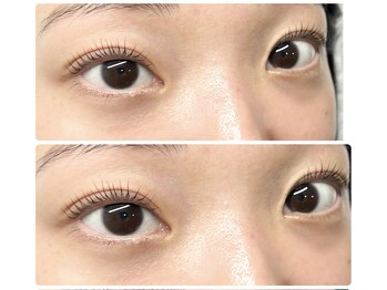 ティピ(tipi)/ラッシュリフト