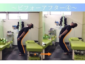 ケアるら整骨院 富里院/ビフォーアフター