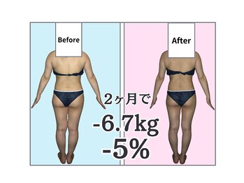 ビューティースリム リボーン 新宿店(reborn)/【痩身】全身痩せを可能に!