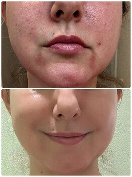 エーエフビューティーエステ(AF Beauty Esthetic)/肌が変わると人生も変わる