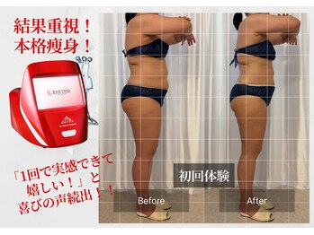 フルール(fulu-lu)の写真/【大人のハミ肉・たるみ肉を改善】15年の実績×結果主義！筋膜と脂肪にアプローチして劇的サイズダウン