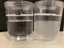 スピカ スターレイビュー(Spica Starry view)/ハイドロフェイシャル汚れ比較