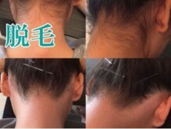 レディース ビホウ(BIHOU)/