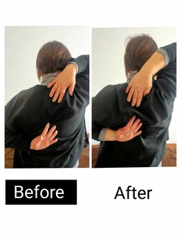 アース エンジェル整体院/ビフォアフ 肩甲骨はがし