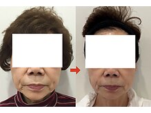 高専まえ整体院/フェイシャルIPL