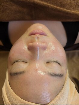 ウル(Ulu)/夏ピーリングでお肌のデトックス