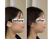 ベルガ 福岡店(Bellega)/