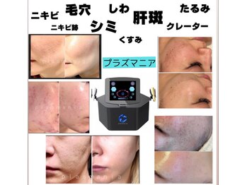 ビューティーネイル(Beauty Nail)/プラズマニア