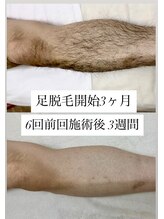 ヴィアージュ/メンズ脱毛