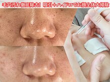 毛穴汚れごっそり取り除きますハイドロ、ピーリング、毛穴ケア