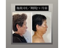 真美(Sinbi)の雰囲気（自信を取り戻してマスク生活とも、サヨナラ！おしゃれが楽しく♪）