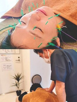 鍼灸施術を受けたい