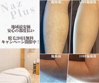 ナーズプラス リベルテ(Naz Plus/Liberte)