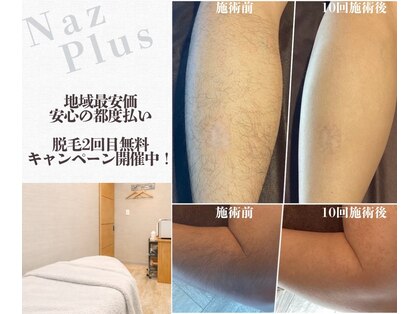 ナーズプラス リベルテ(Naz Plus/Liberte)の写真