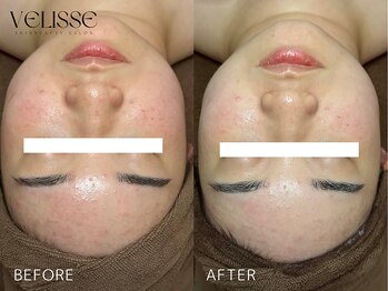 ヴェリス 福岡店(Velisse)/