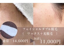 ナナイロサロン フクオカ(NaNairoサロン Fukuoka)/スキンケアフェイシャルWAX