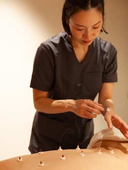 インヤン美容鍼 鍼灸治療院 表参道外苑前院/お灸