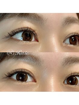 レビー(Revie)/バインドロック &nbsp;80束