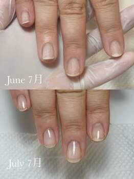 ネイルズ バイ ユイ 外苑前(Nails by Yui)/自爪育成ジェルネイル1ヶ月目